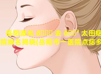 岳阳激光 🐝 去 🐳 太田痣医院排名揭晓(岳阳市一医院点痣多少钱一个)